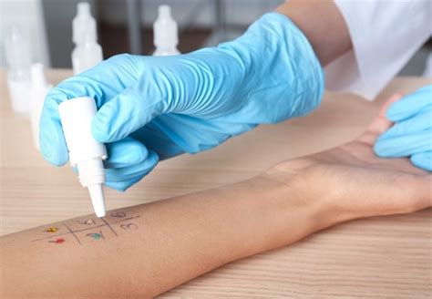 skin allergy testing procedure